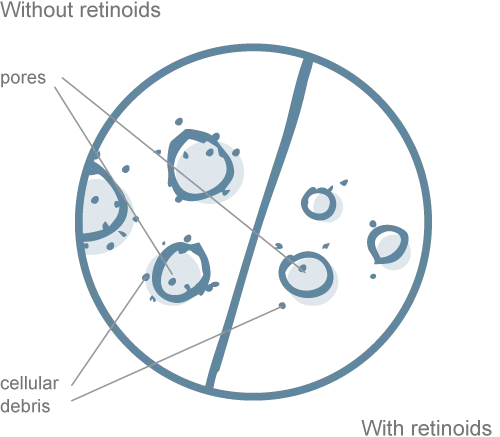 A pie chart divided into five segments, with a diagonal line across two segments. Two arrows point to these segments, labeled "internal" and "external.