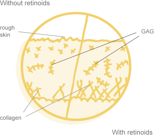 A pie chart showing various label positions, with annotations pointing to different sections around the yellow circle.